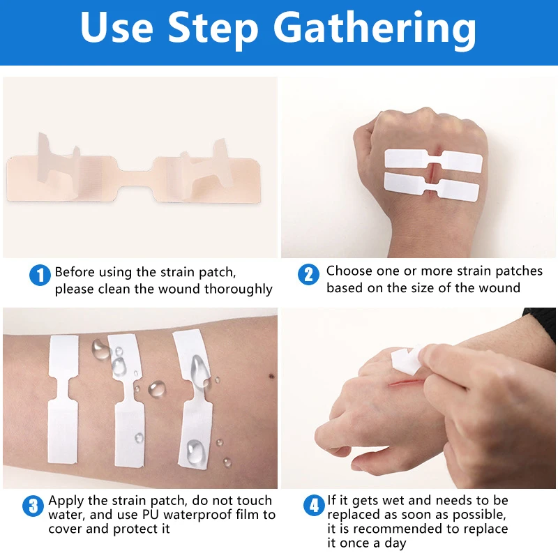Strisce per bendaggi con chiusura a farfalla Punti adesivi Ferite Cuscinetto antiaderente per la pelle 1/3/10/50 Toppe - Medicazione medica per tagli e rottami