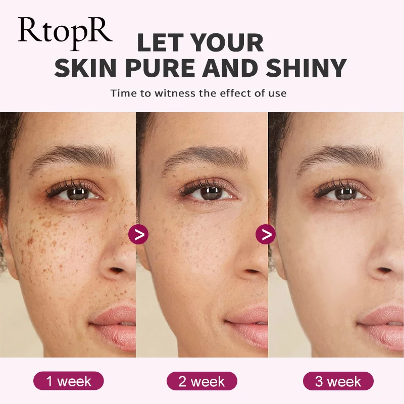 ビタミンCカタツムリエッセンス,アンチエイジング,しわ防止,毛穴の美白,保湿,オイルコントロール,フェイスケア