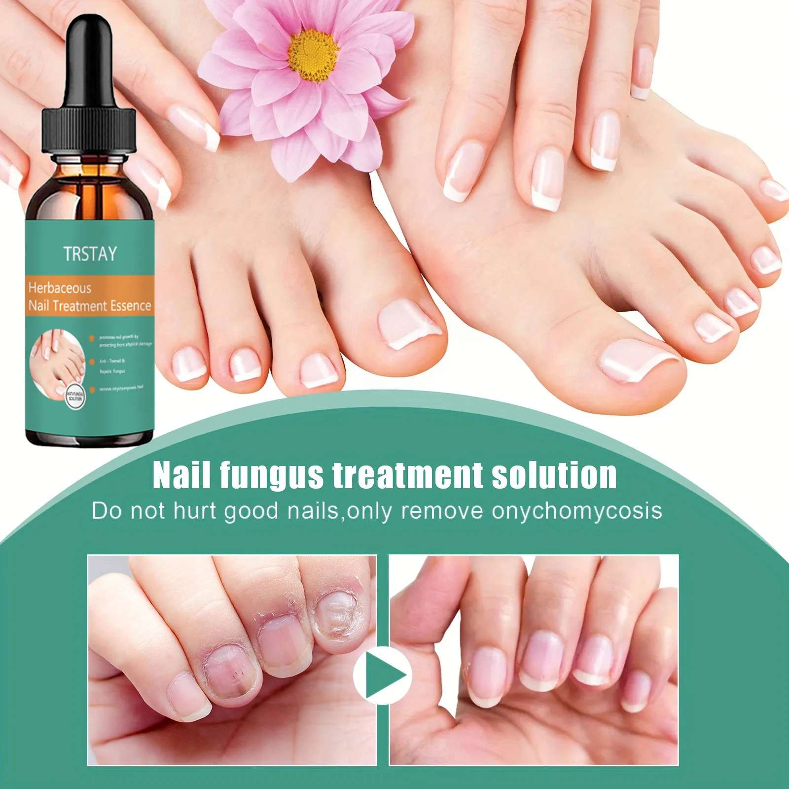 Orange Nail Care Cream, Repair Nails, Keep Nails In Good Condition, Moisturize Nails, And Change The Appearance Of Nails