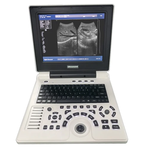 XF30B Portable Ultrasound Scanner for Human & Veterinary