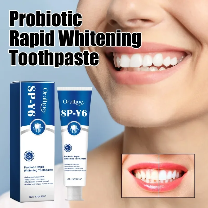 Probiotic Rapid Whitening Toothnaste Brightening & Stain Removing SP-Y6 Probiotic Toothpaste Long Lasting Fresh Breath Oral Care