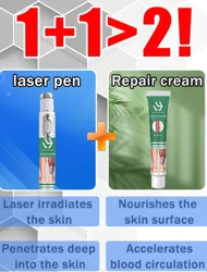 Laser Therapy For Varicose Vein Treatment Effective Relieve Legs Dilated Vasculitis Phlebitis Improve Circulation Blue Light Pen