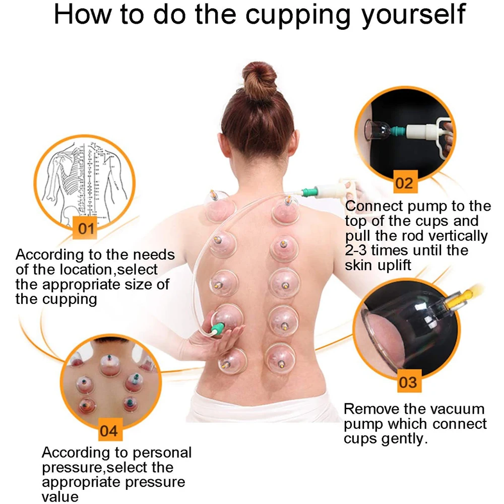 Conjuntos de terapia de ventosas, Hijama, ventosas de vacío, 24 tazas, masaje de ventosas para celulitis, alivio del dolor de espalda, ventosas chinas