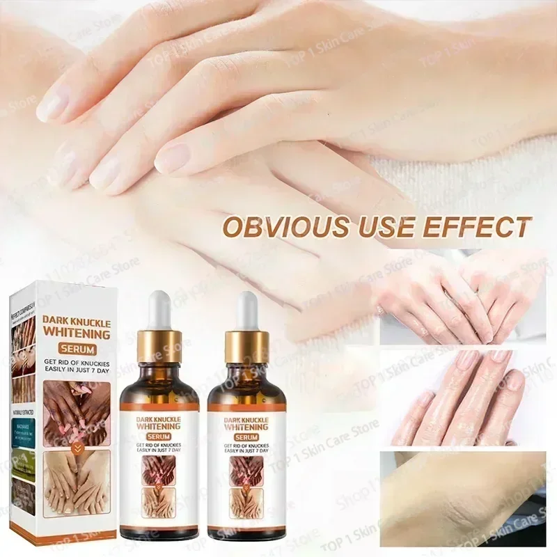 Hot sales knuckles whitening Essence For Lip Areolas Private Parts Tender Remove Intimate Melanin Skin Care Whitening Dark Spot