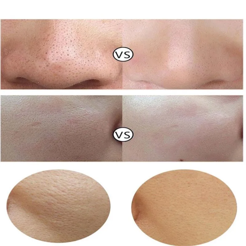 Thuisgebruik Hydra Dermabrasie Aqua Peeling SPA Schoonheid Machine Gezicht Hydratatie Sproeier Waterinjectie Vacuüm Mee-eter Gezicht Schoon
