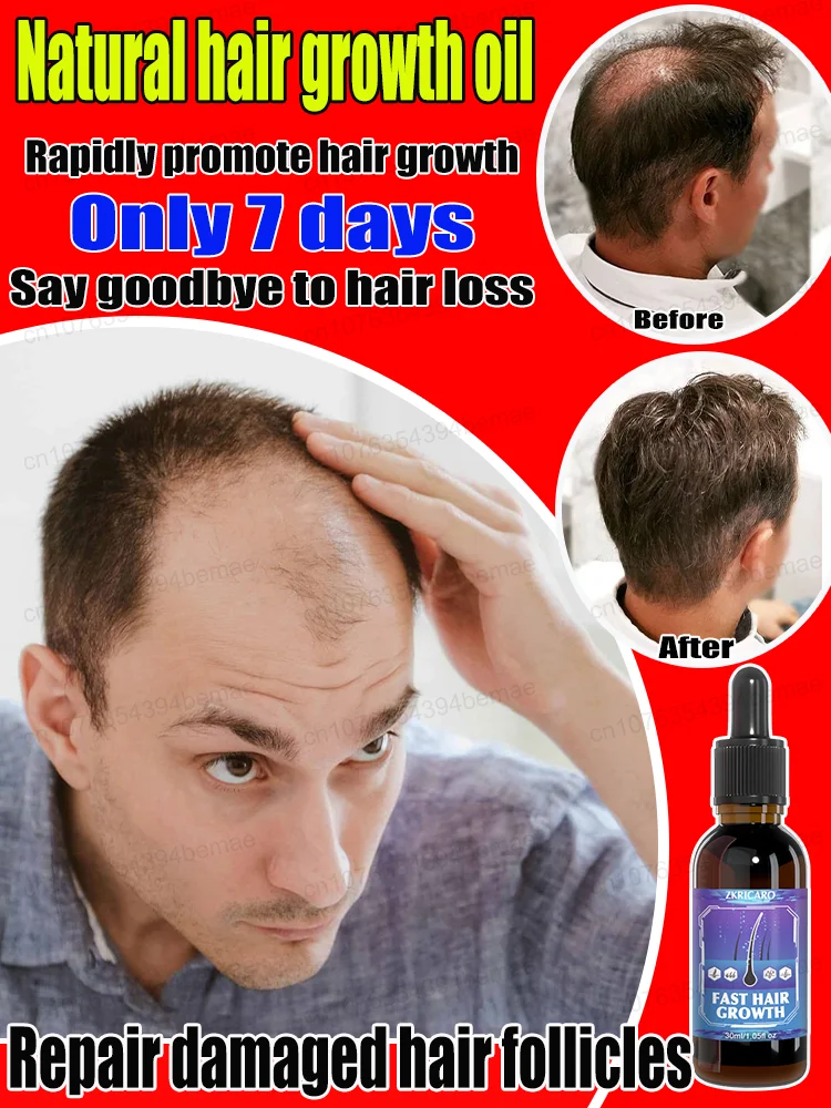 

ʰᵃⁱʳ ᵍʳᵒʷᵗʰ ᵉˢˢᵉⁿᶜᵉ Promote rapid hair growth, repair bald spots and say goodbye to baldness.