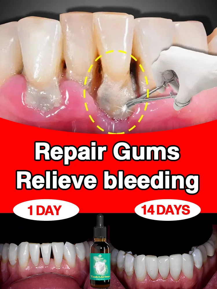 

Gum Soothing Drops, repair gum recession, relieve gum bleeding and tooth pain