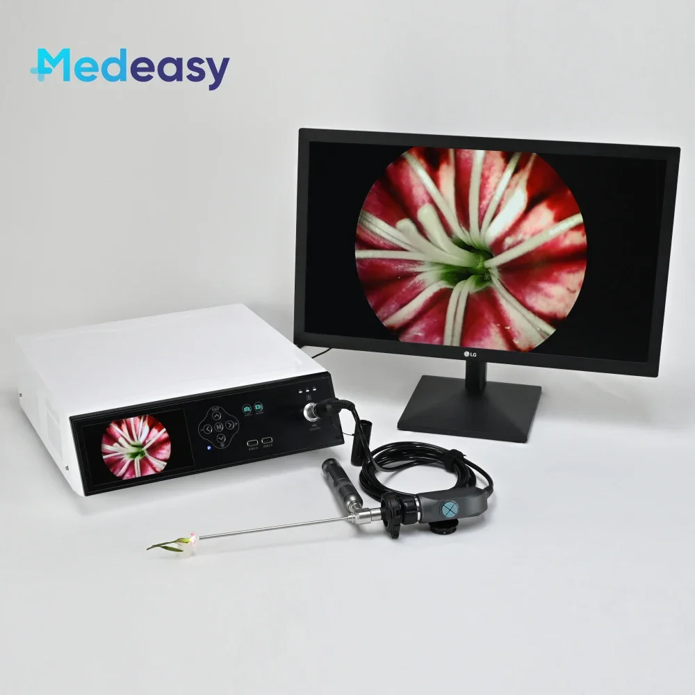 

Full HD 1080P Endoscope Camera System with 6 Inch Display Screen and USB Record