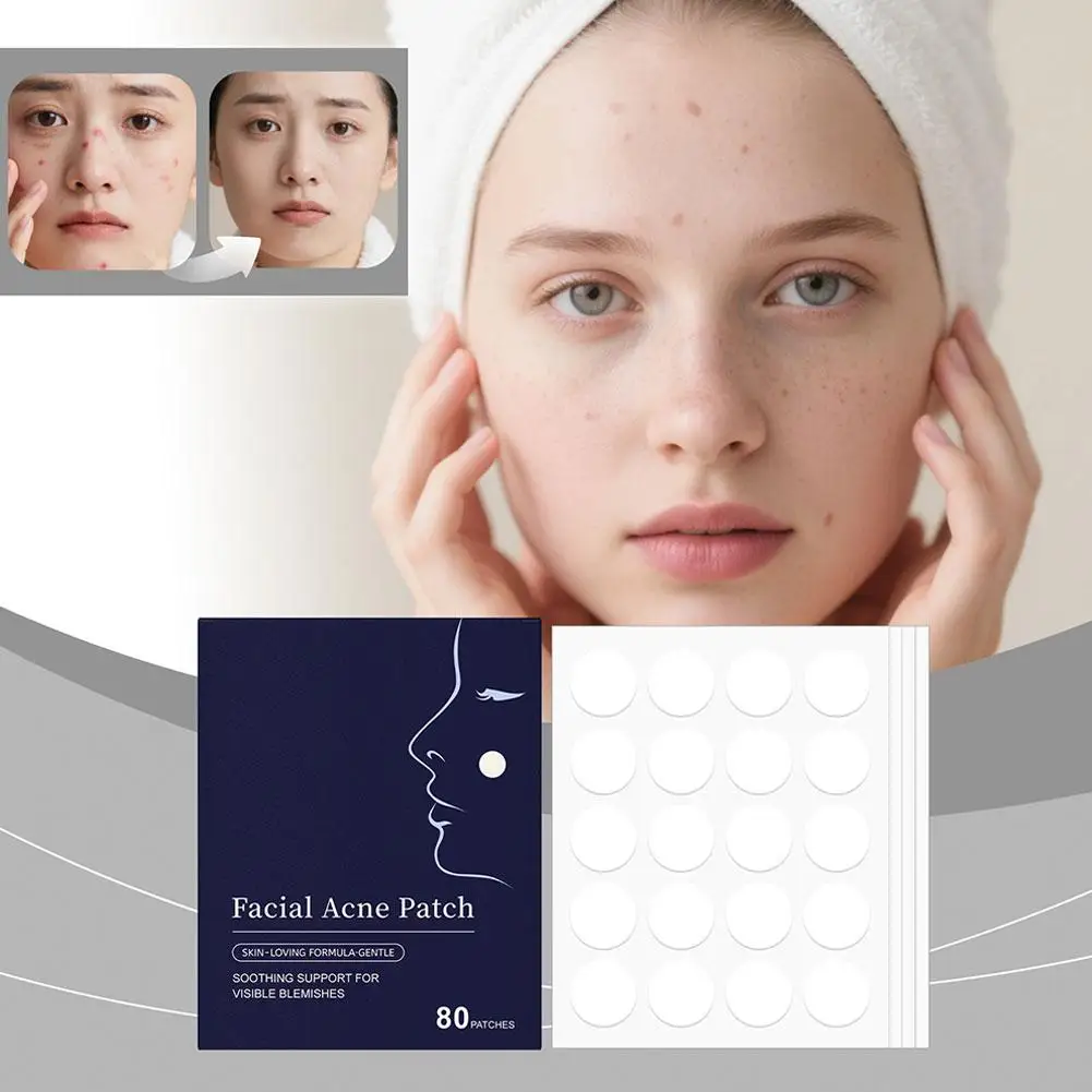 80pcs Facial acne patch Acne Blackheads Closed Comedones Improve Acne-prone Skin Gentle Formula Suitable For Daily Use