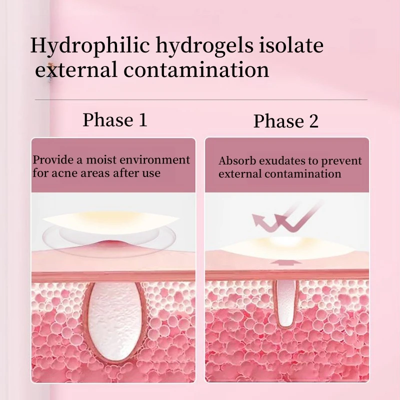 Hydrocolloid Acne Patch Selling Invisible Makeup Close Patch Clear, Waterproof and Breathable Acne Muscle Repair Pack