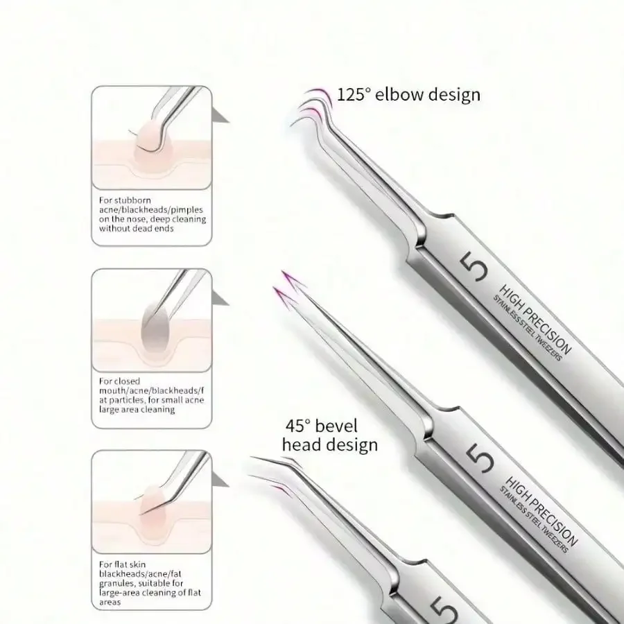 Kit di strumenti per la rimozione di punti neri in acciaio inossidabile da 8 pezzi, clip per punti neri, pinzette, rimozione di punti neri per il viso di bellezza, strumento per ago per l'acne
