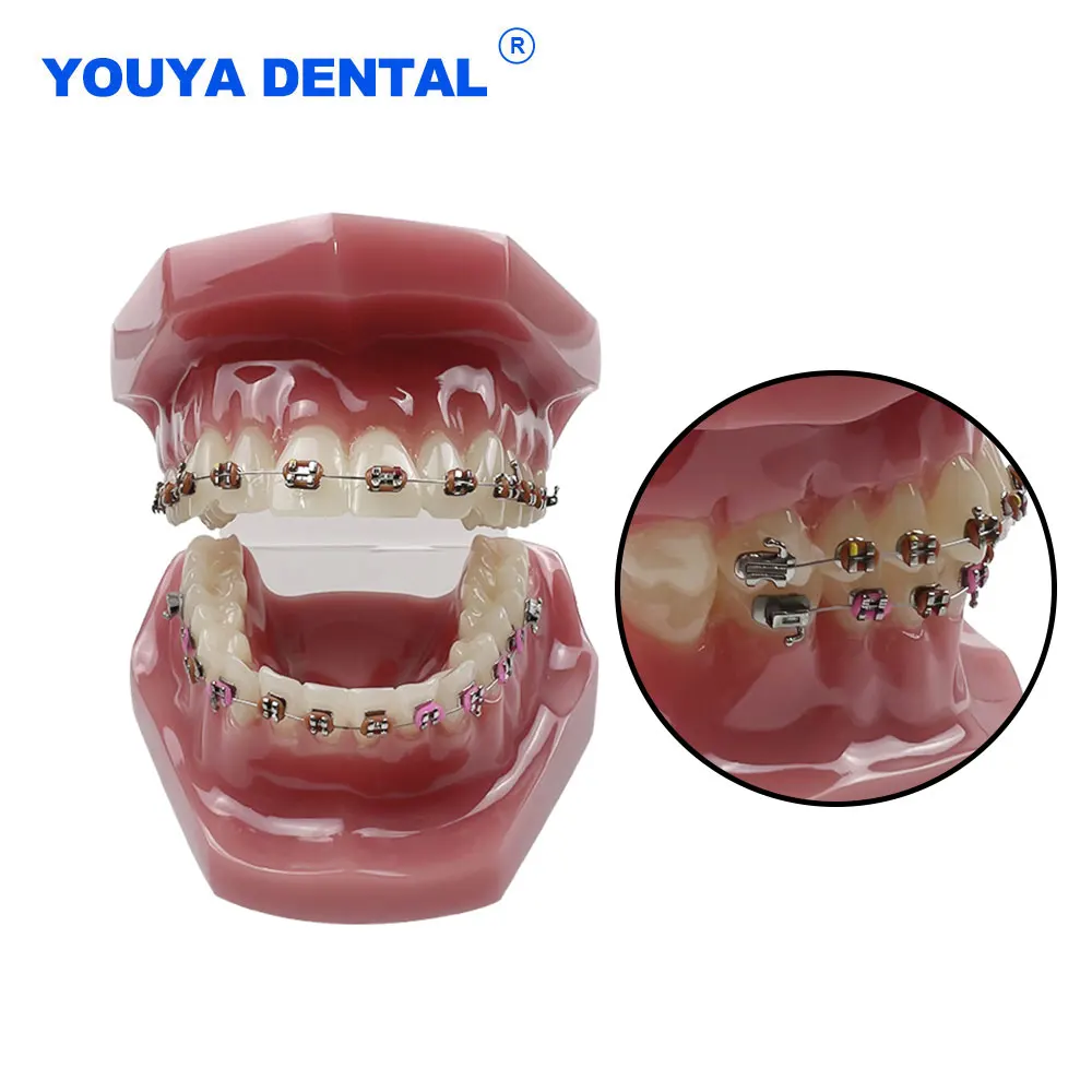 Typodont Teeth Model Dental Orthodontic Model with Full Metal Bracket Arch Wire Buccal Tube Ligature Ties For Dentist Student