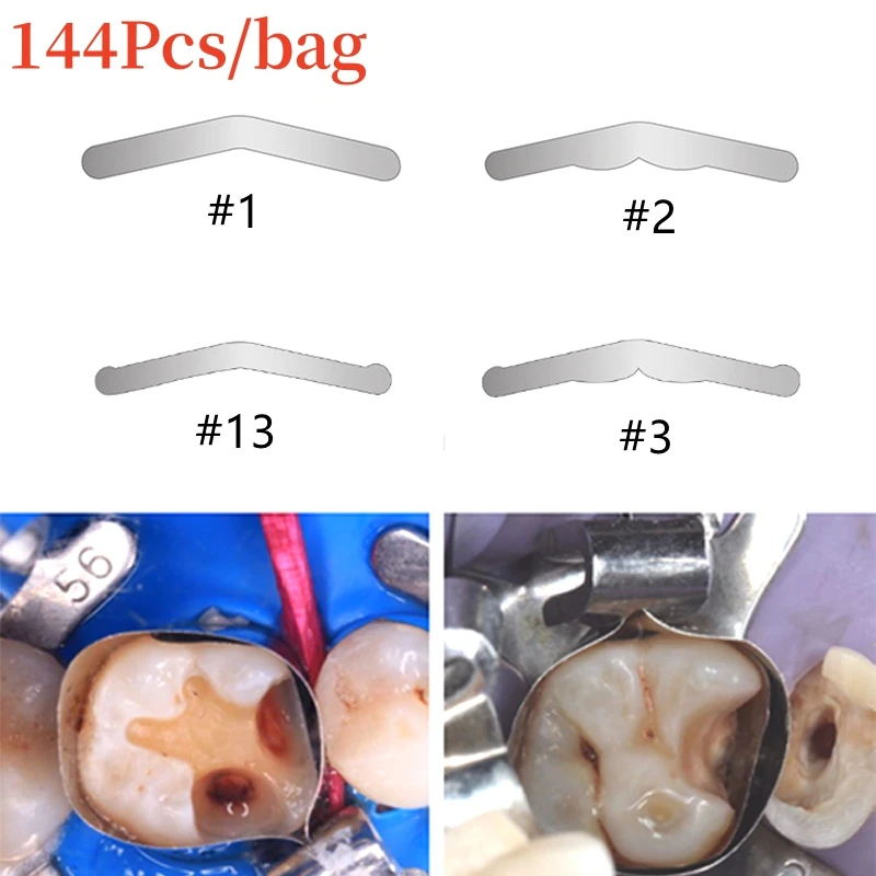 144 sztuk/worek dentystyczne opaski na matrycę toflemire 0.04mm wyprofilowane matryce matrycowe narzędzia do naprawy zębów materiały stomatologiczne