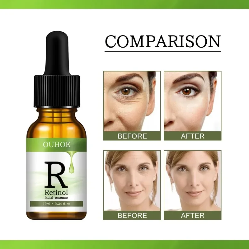 Suero Facial con Retinol, esencia blanqueadora antiedad, antiarrugas, ilumina la cara, cuidado de la piel, Lifting, reafirmante, desvanecimiento de los ojos, hidratante de líneas finas