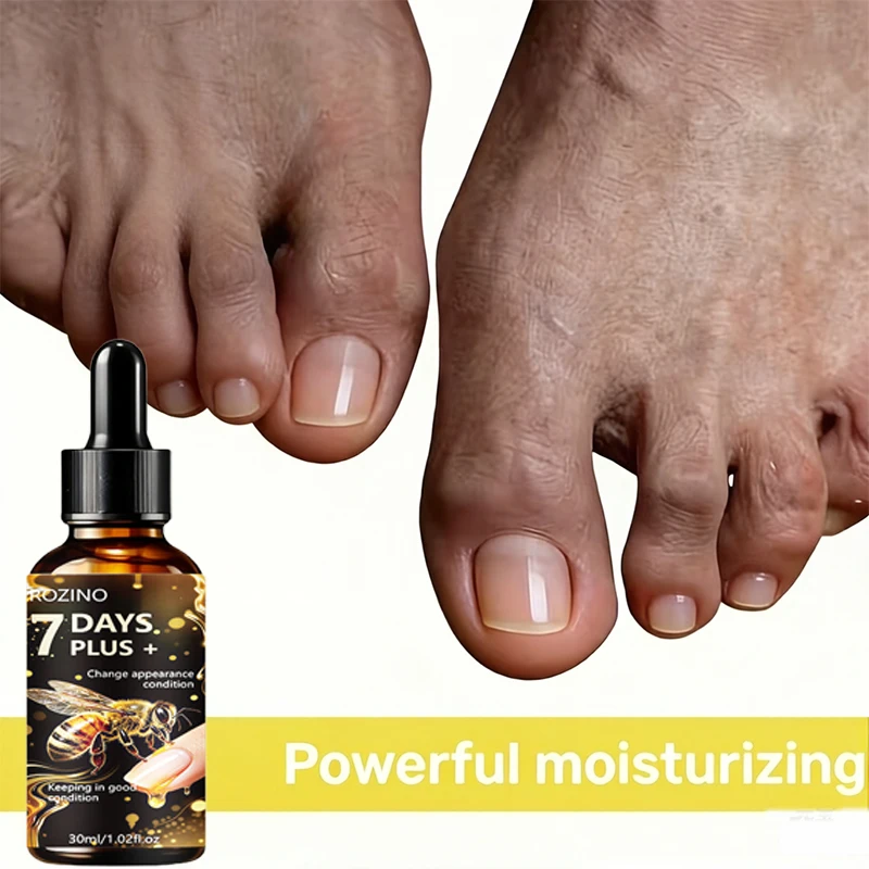 ROZINO nail serum has a clear and hydrating texture, and comes with a smooth brush head for even application on the nail surface and cuticles. Multiple nourishing ingredients penetrate deeply into the nail bed, repairing thin, soft, and damaged nails, improving splitting, breakage, and vertical lines on the surface. It also softens dry skin around the nails, alleviates hangnails and cracking, and absorbs quickly without being sticky. Long-term use strengthens nail structure, suitable for post-manicure repair and daily care for fragile nails. view 2
