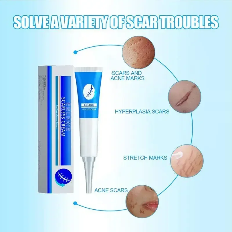 Scar Repair Cream Acne Scar Stretch Mark Remover For Burn Scars Old Postoperative Removal Skin Smoothing