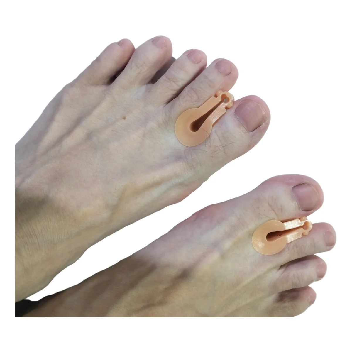 1/10Pairs Toe Straightener Clip Thumb Valgus Protector Gel Foot Fingers Splitter Separator Bunion Adjuster Feet Pads Pain Relief