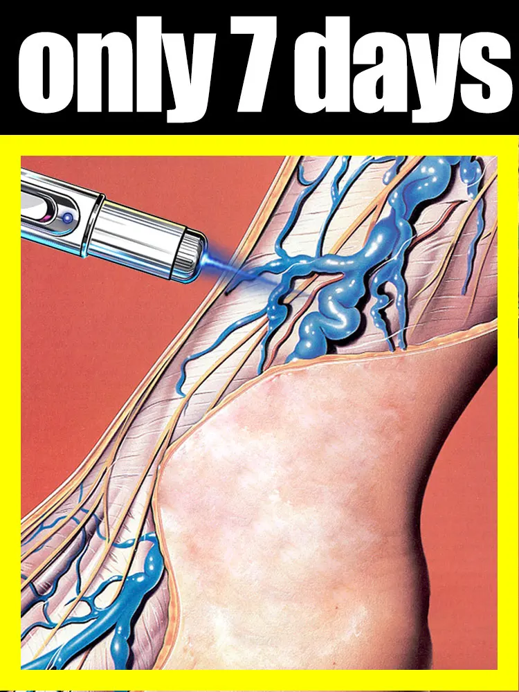 

Бесплатная доставка, помощь людей с ногами решают их проблемы и отсутствие угощений, простое и удобное тело, хит продаж 2025 года.