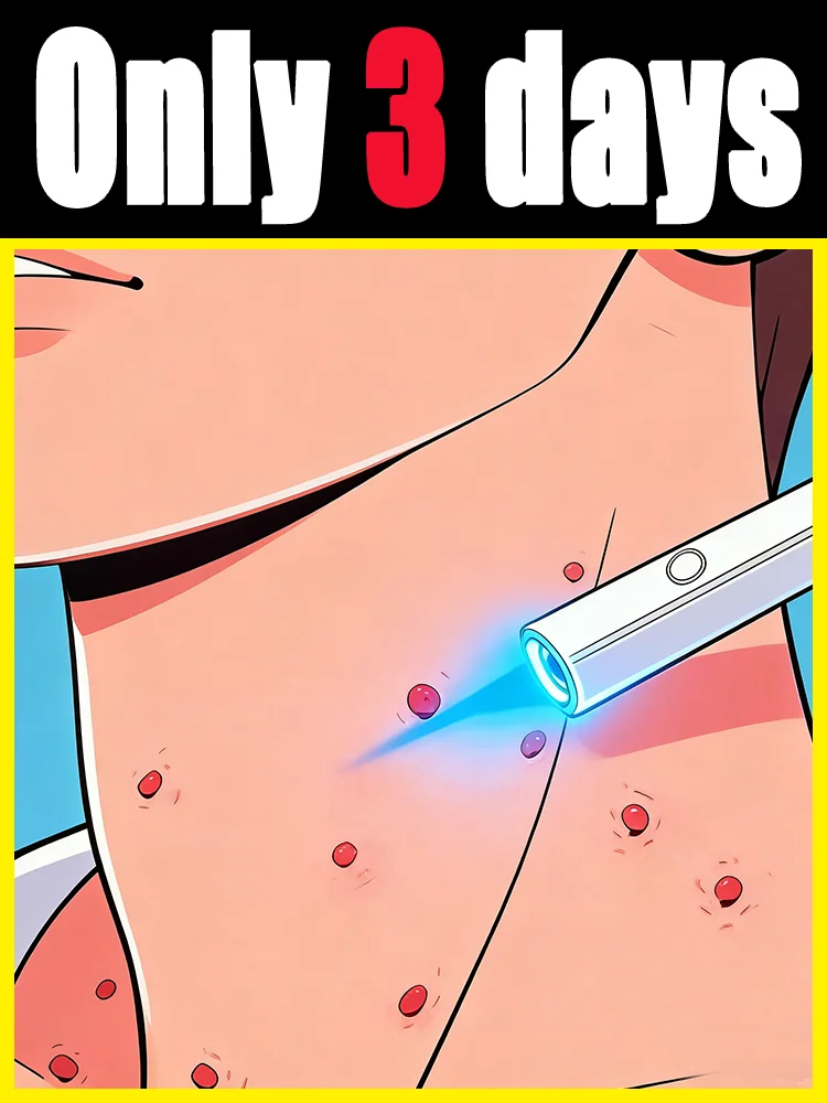 

These inconspicuous little bumps not only affect ᵒⁿᵉ'ˢ ᵃᵖᵖᵉᵃʳᵃⁿᶜᵉ ᵇᵘᵗ ᵃˡˢᵒ ᶜᵃᵘˢᵉ ᵖᵃⁱⁿ‧