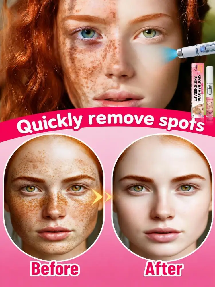 Household Facial Skin Care Beauty Pen, Optimize Visible Facial Spots Look, Balance Uneven Skin Tone, Lightweight Hand‑Held Skin Device for At‑Home Daily Facial Beauty Care
