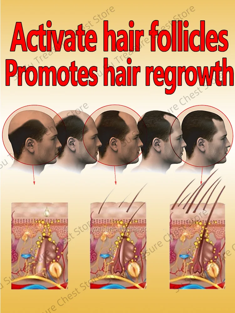 اشتر 5 واحصل على 5 مجانًا من زيت الشعر العضوي المبيعات الساخنة، مناسب للشعر الكثيف والطويل عرض خاص