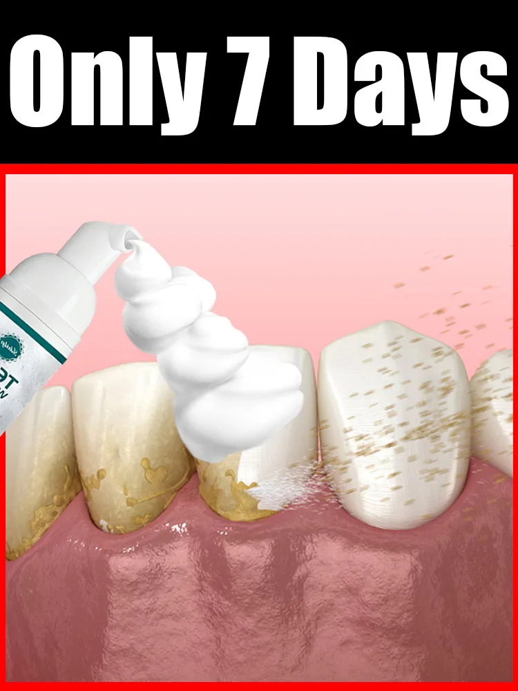 Intraoral care tools Lots of foam Intraoral Mousse solves various Intraoral problems