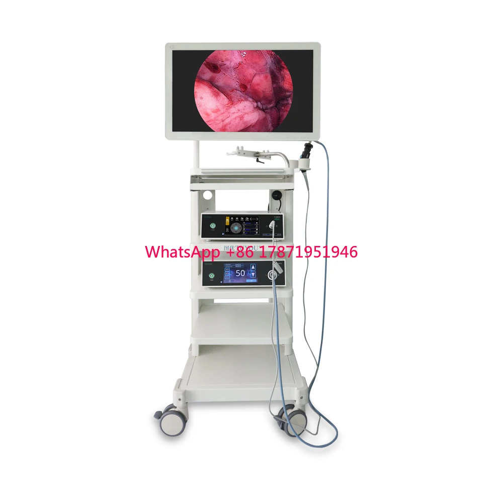 

TUYOU 2024 New Design 4k HD Medical Endoscopic Endoscope Camera System With Monitor For Surgery with All Accessories