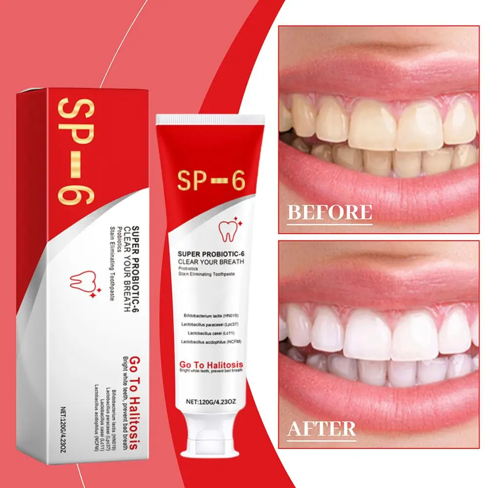 

SP-6 Probiotic Toothpaste Remove Dental Plaque Stains Teeth Agent Breath Whiten Hygiene Teeth Freshness Whitening Clean Ora E5P0