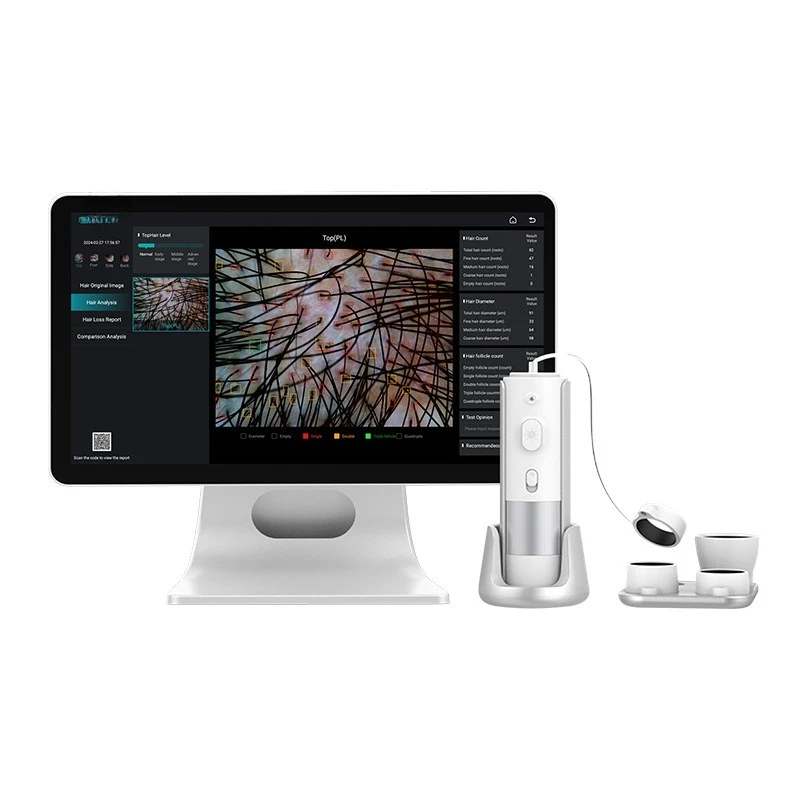 

AI scalp detection analyzer three spectrum high definition analyzer