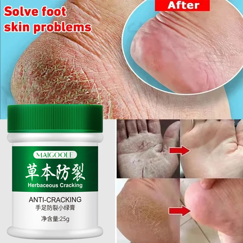 Hand Foot Anti-Cracking Herbal Cream Improve Dry Dry Body Smooth Nourish Cream Exfoliation Dead Skin Heel Cracked Moisturizer