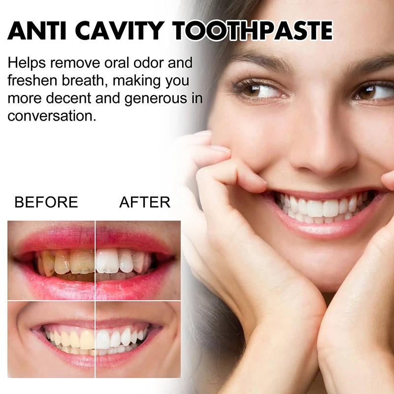 Anti-Yellow Toothpaste Deep Cleaning Tartar Decaying Fresh Breath Whitening Teeth Cleaning Toothpaste