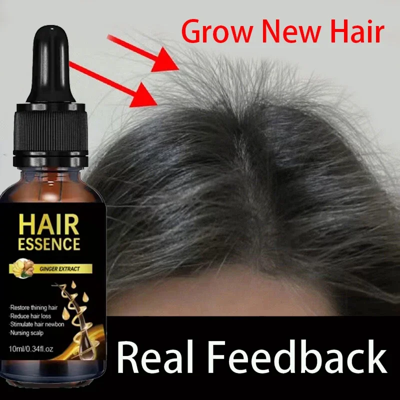 

Hair growth oil effective baldness repair hereditary Anti hair loss postpartum hair loss serum