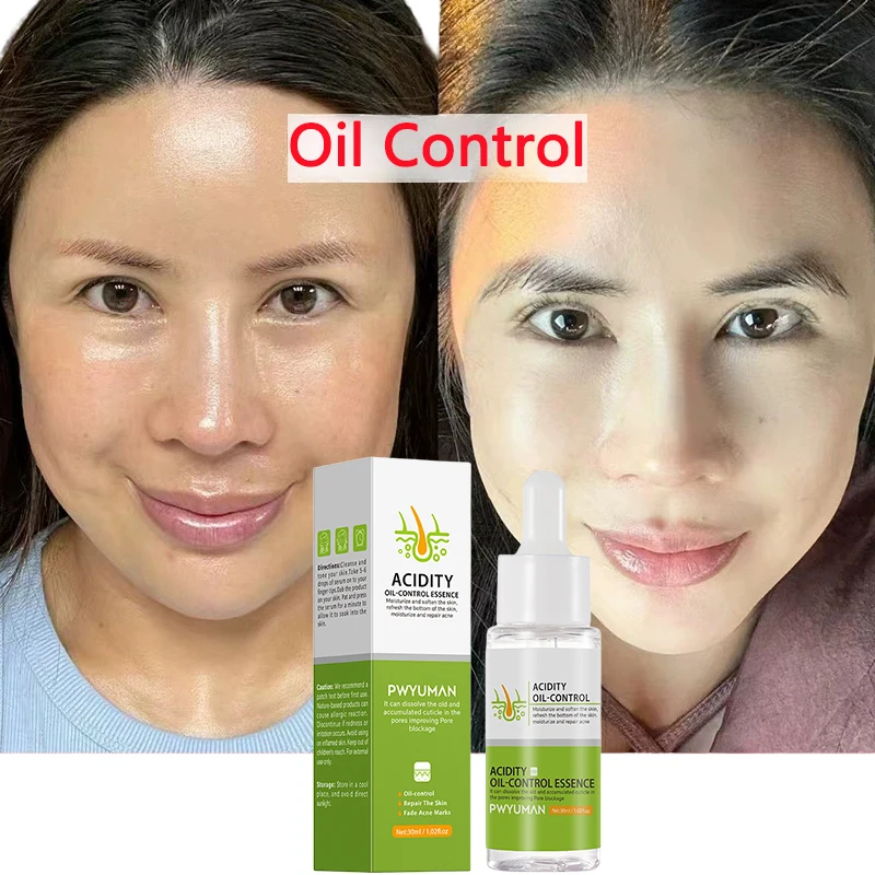 Salicylic Acid Face Serum Control Oil Shrink Pores Rejuvenating Acne Treatment Whitening Moisturizing Korean Skin Care Products