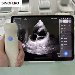 Wireless Color Ultrasound Doppler Phased Array Cardiac probe Support iOS Android Windows with Free Suitcase