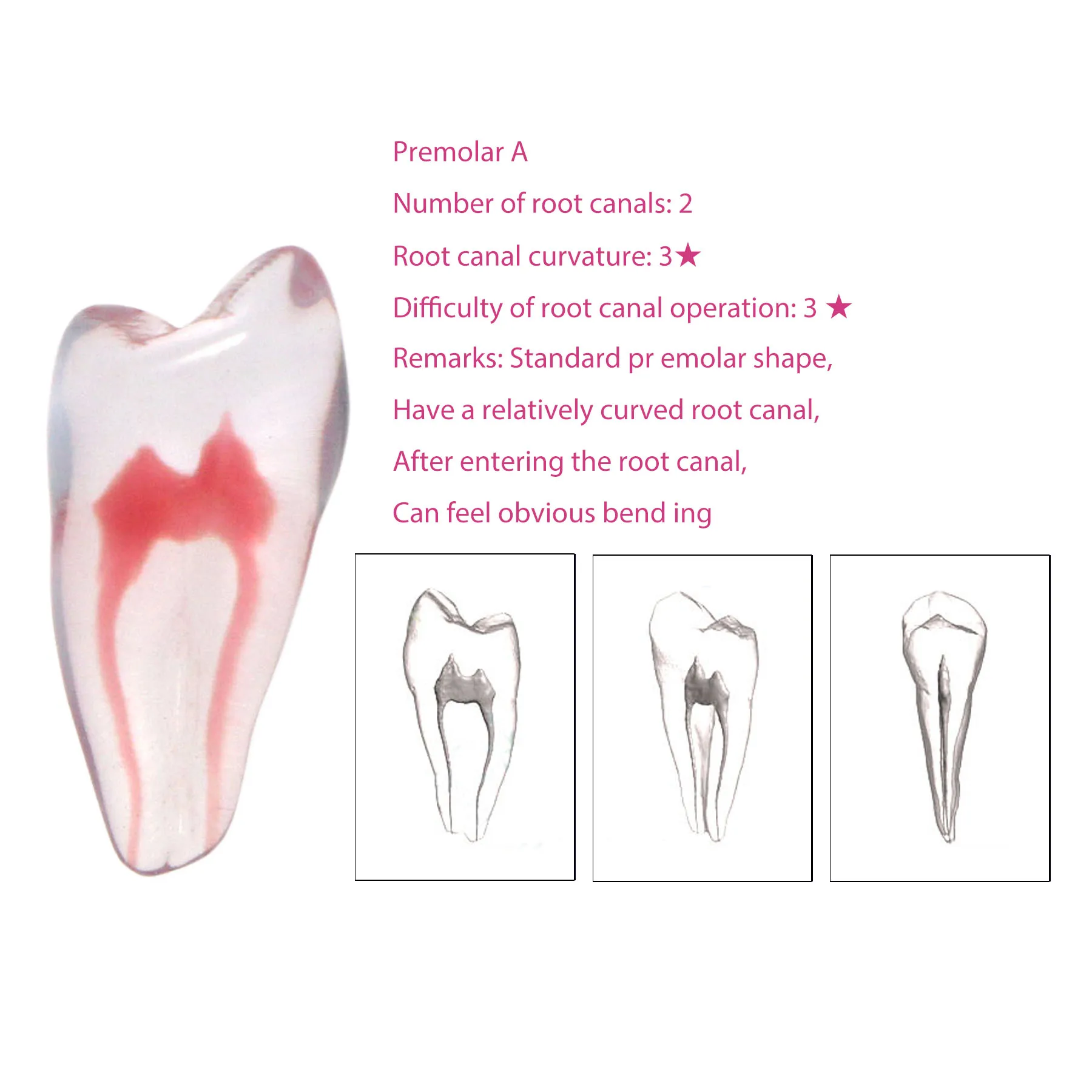 

Premolar A 3D Dental Root Canal Model Practice Model Root Canal Therapy Resin Model Endodontics RTC