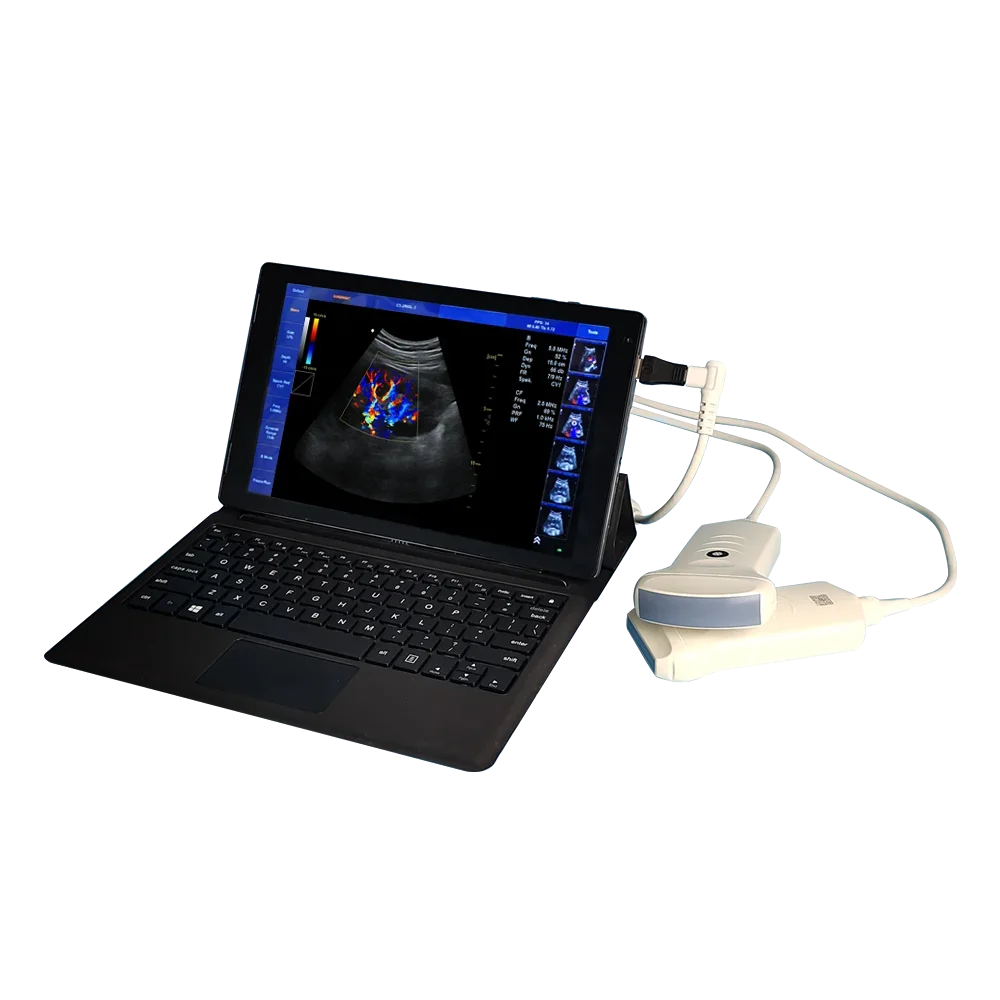 Sun-901A lower price high resolution color doppler PC ultrasound vet use device for dog cat sheep rabbit