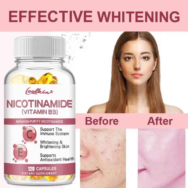 Niacinamide Whitening Capsules - Contains Vitamin B3 To Support Healthy Skin and Immune System, Reduce Wrinkles, Gluten-free