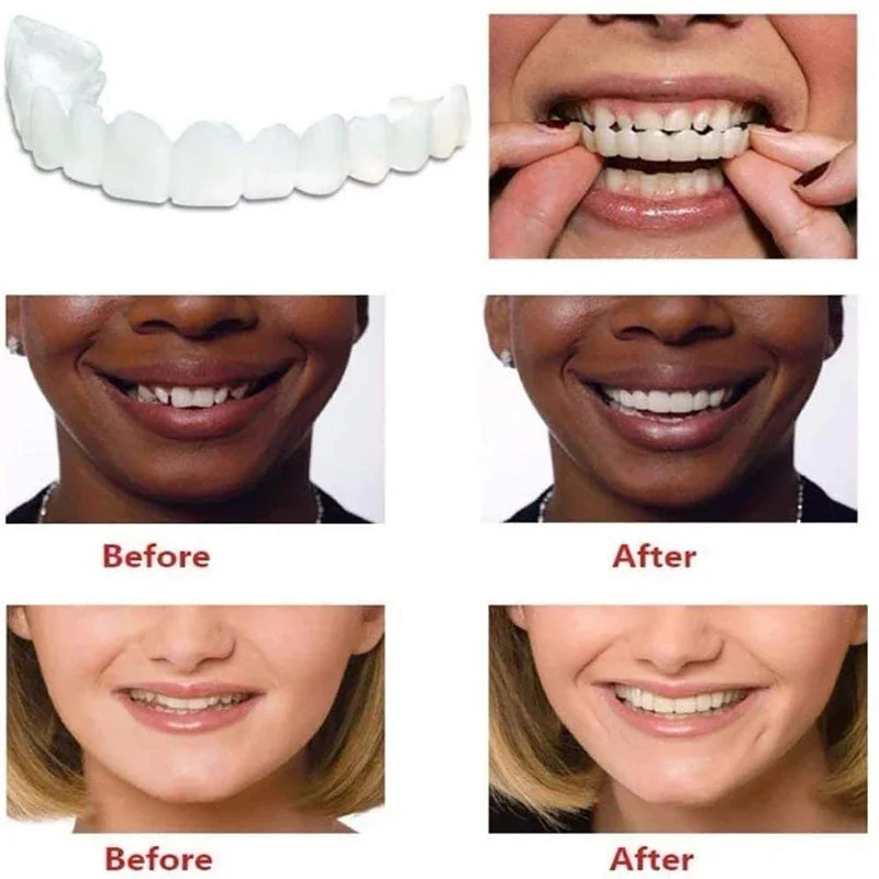 2Pcs/Set Upper Teeth Lower Teeth Silicone Whitening Cover Teeth Braces Simulation Denture with Box Perfect Smile New