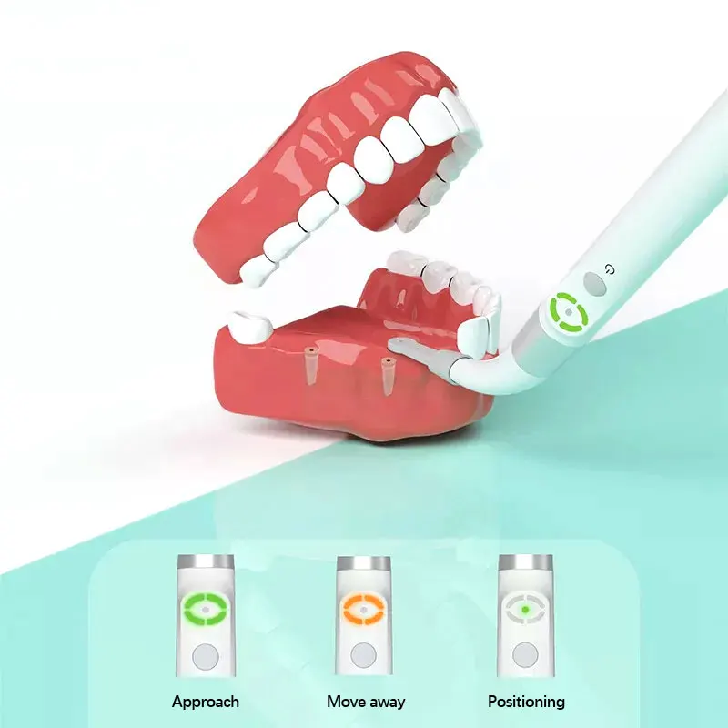 

360° Rotatable ID1 Dental Implant Locator - Cross-Scanning Spot Detector & Screwdriver Tool for Accurate Placement