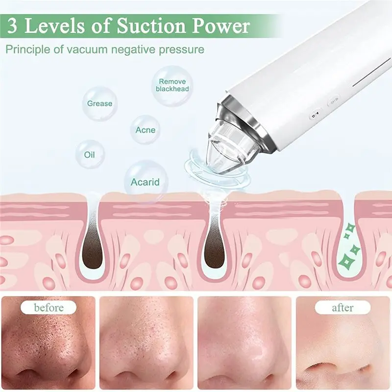 24-Hour Delivery Acne Pimple Comedone Extractor Kit With HD Camera, Blackhead Remover Pore Vacuum Facial Cleaner