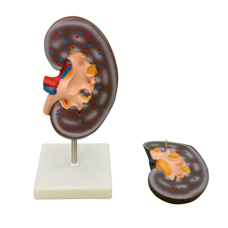 Life Size Kidney Model 2 Parts Human Anatomy Kidney Models for Medical Student