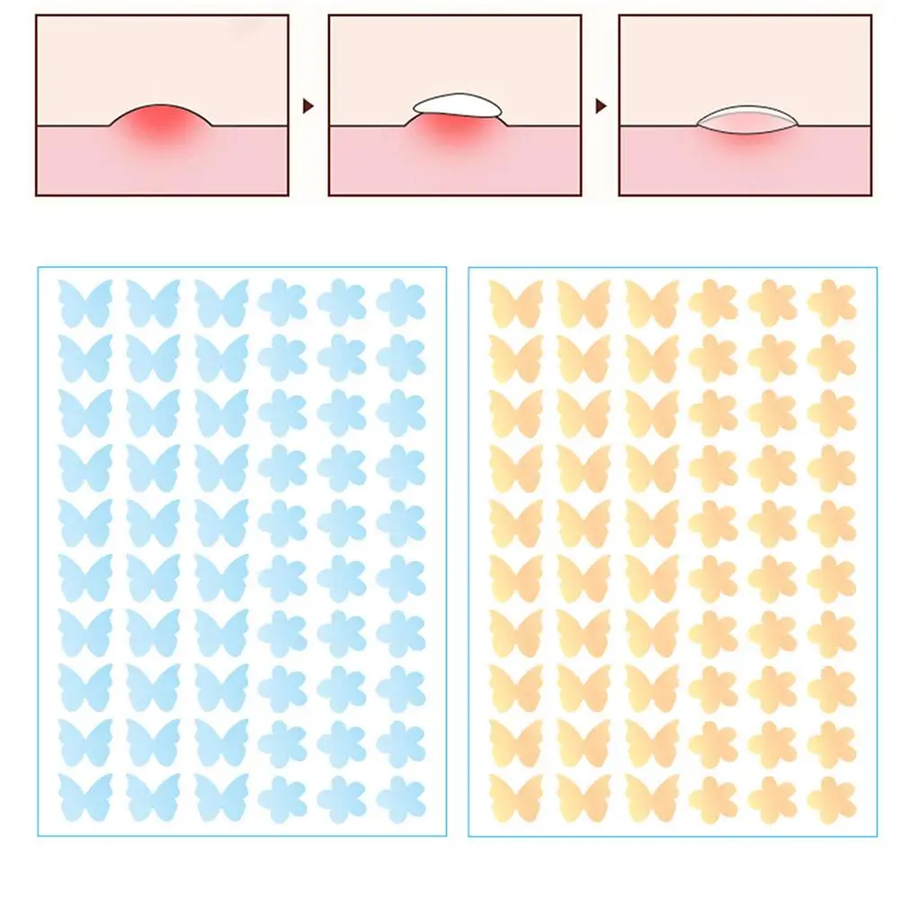 رقع حب الشباب على شكل فراشة غرواني مائي غطاء بثرة غير مرئي لطيف وغير مزعج للاستخدام اليومي بقع حب الشباب