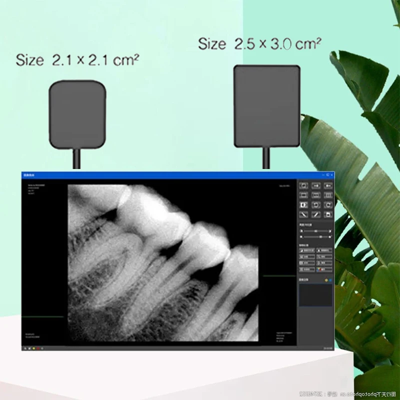 Sensor Dental de alta frecuencia, sistema Digital Intraoral Rx, imagen H D, Odontología de rayos X