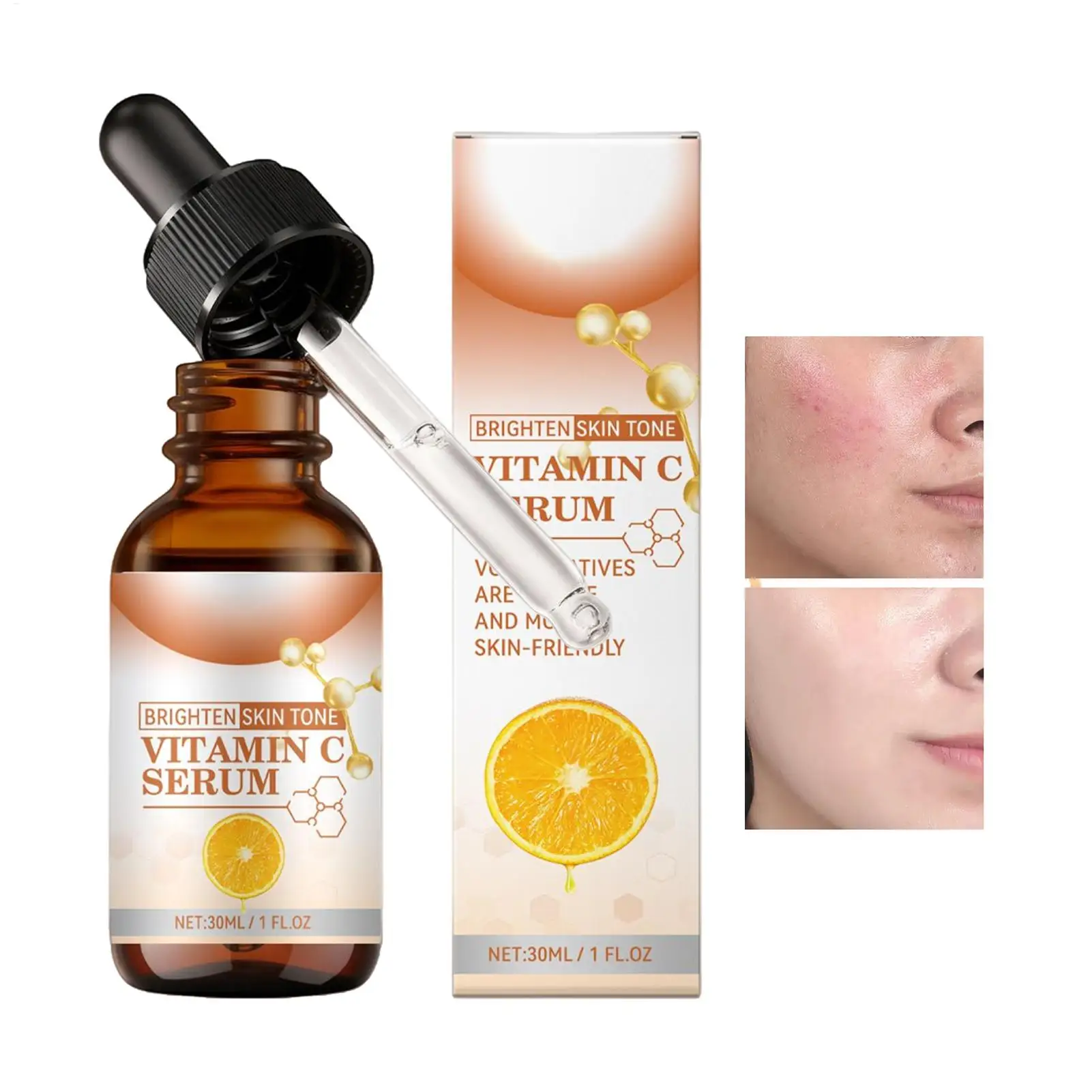 Sérum de Vitamina C 30ml com Ácidos Hialurônicos Removedor de Manchas Escuras Hidratante Reparador Anti-envelhecimento Reduz Linhas Finas Repara a Pel