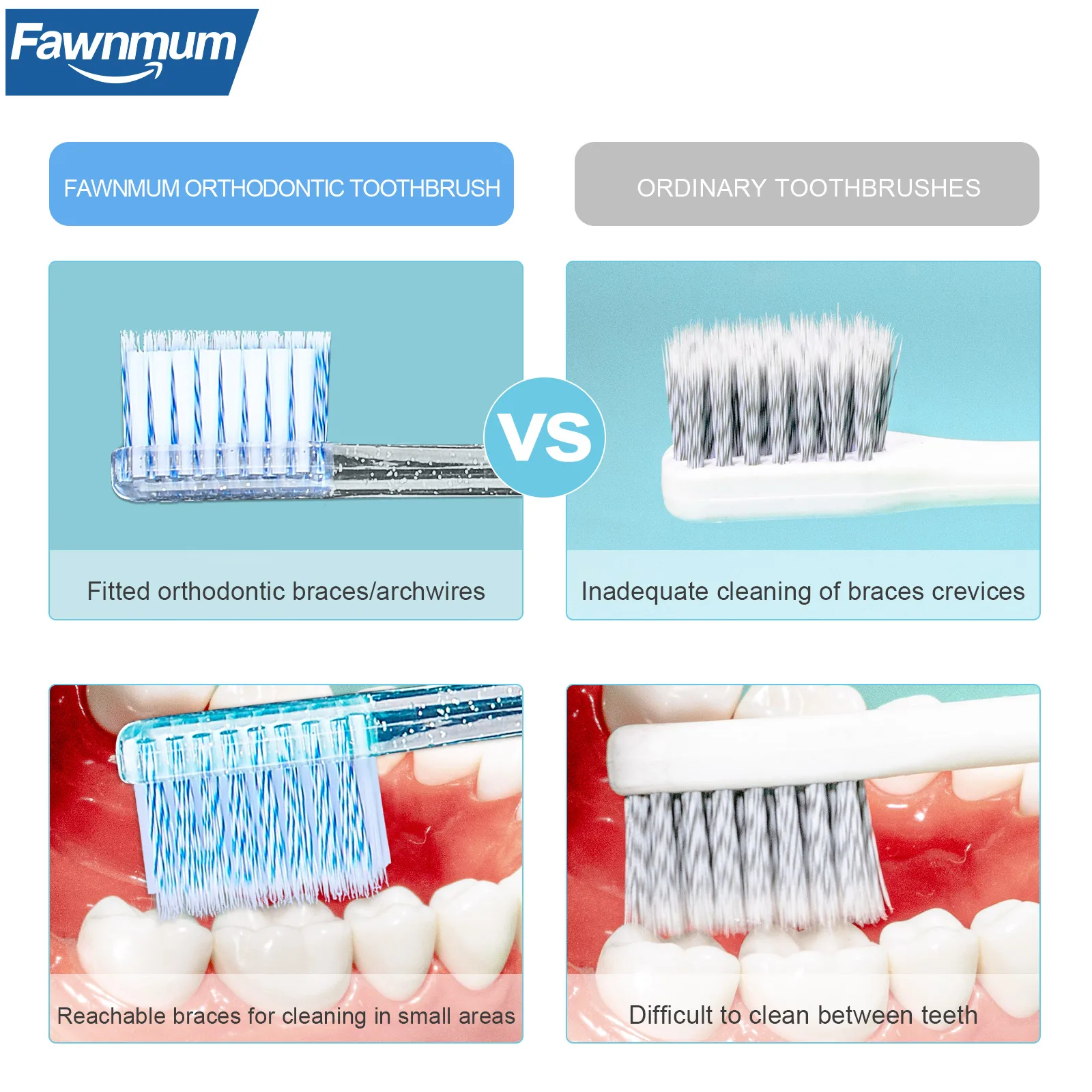 2Pcs Fawnmum Orthodontic Brush Brace Clean Oral Hygiene Toothbrush Soft Bristles Interdental Brush Health Oral Cleaning Tool