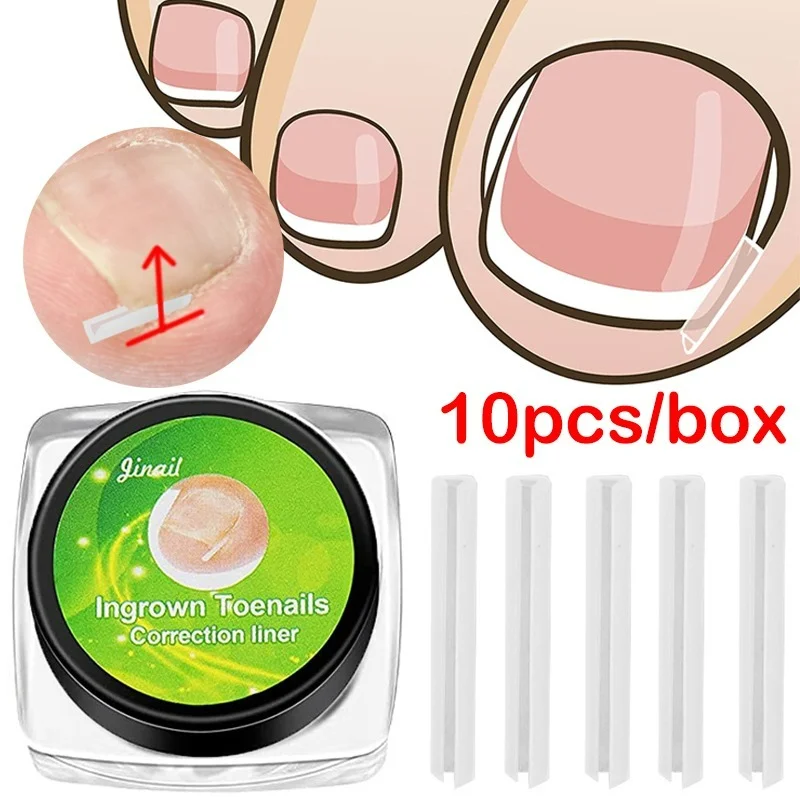 10pcs/box Paronychia Filling Strips Quickly Ingrown Toenail Correction Tool Straightening Toe Nail Treatment Brace Pedicure Tool