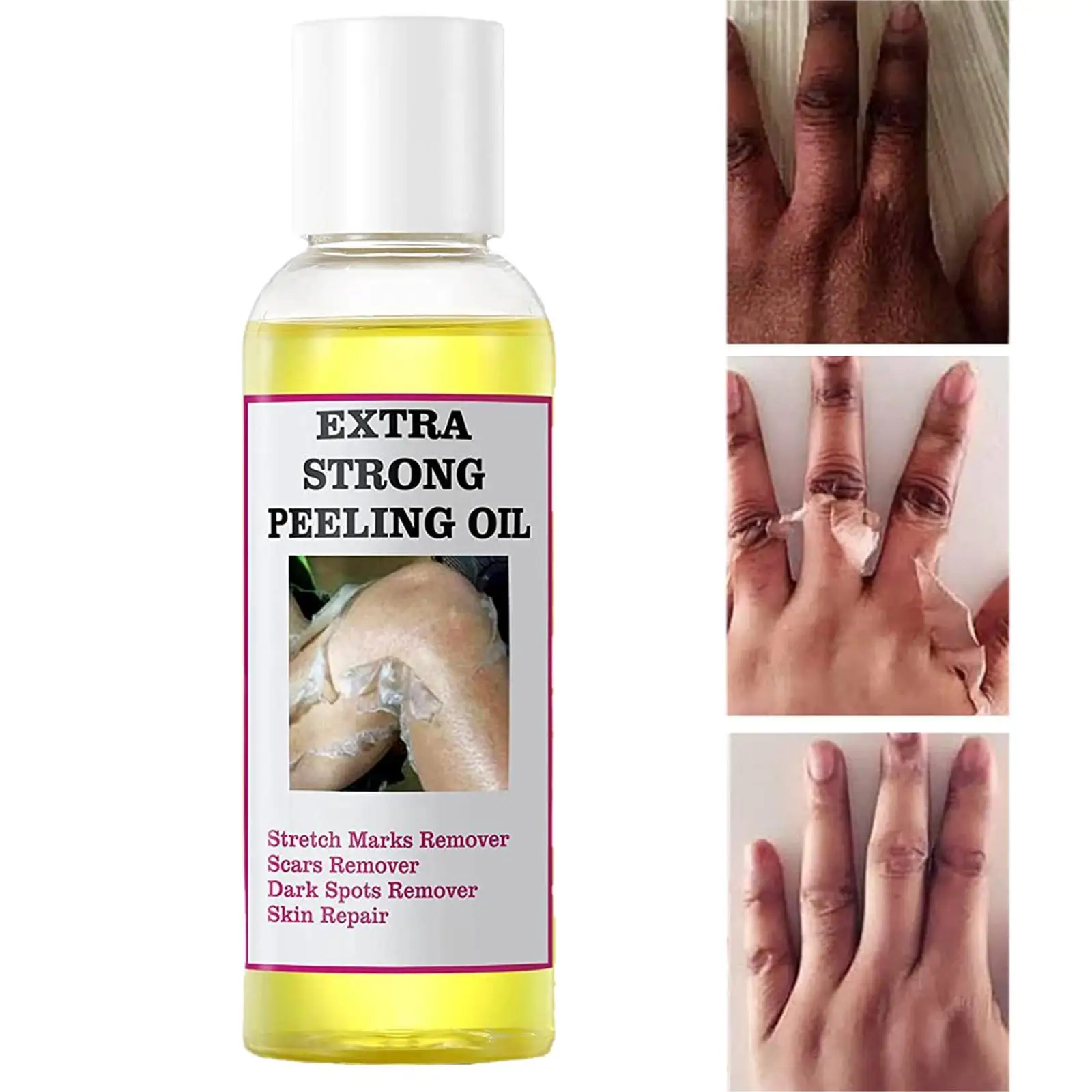 Aceite Peeling amarillo fuerte, aceite blanqueador, blanqueador, codos, rodillas, manos, tono de piel uniforme y aclaramiento de la piel, 30ml