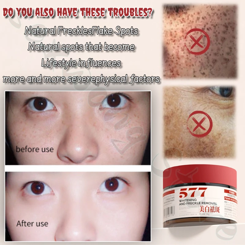 Whitening and Translucent Freckle Removal Cream Dilutes Various Stubborn Spots and Inhibits Melanin 577 Freckle Removal Cream