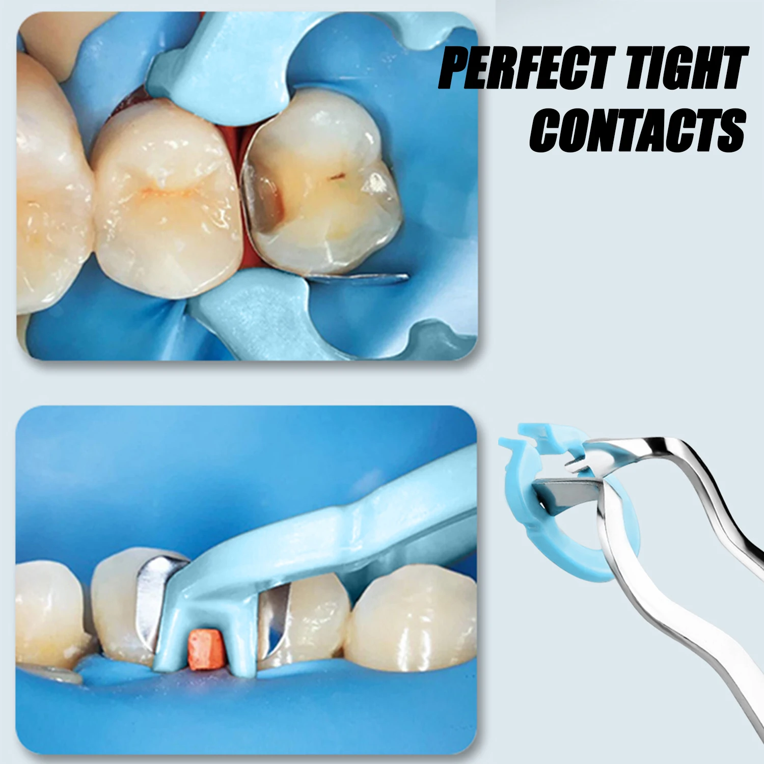 Dental Resin Clamp Dental Dam Clip Matrix System Autoclavable High Heat Resistant Separator Ring Dental Lab Dentistry Material