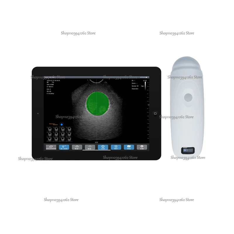 4D Wireless Bladder Scanner Handheld Bladder Scanner Portable Bladder Ultrasound Scanner